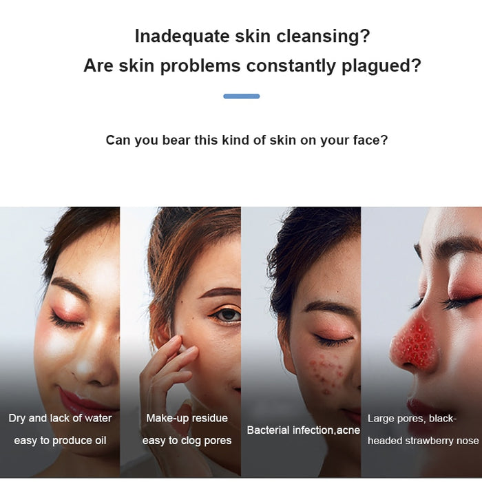 Electric Small Bubble Blackhead Remover - foxberryparkproducts